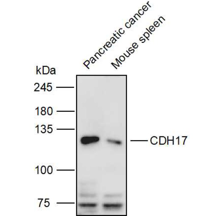 Solarbio K P Anti Cdh Polyclonal Antibody