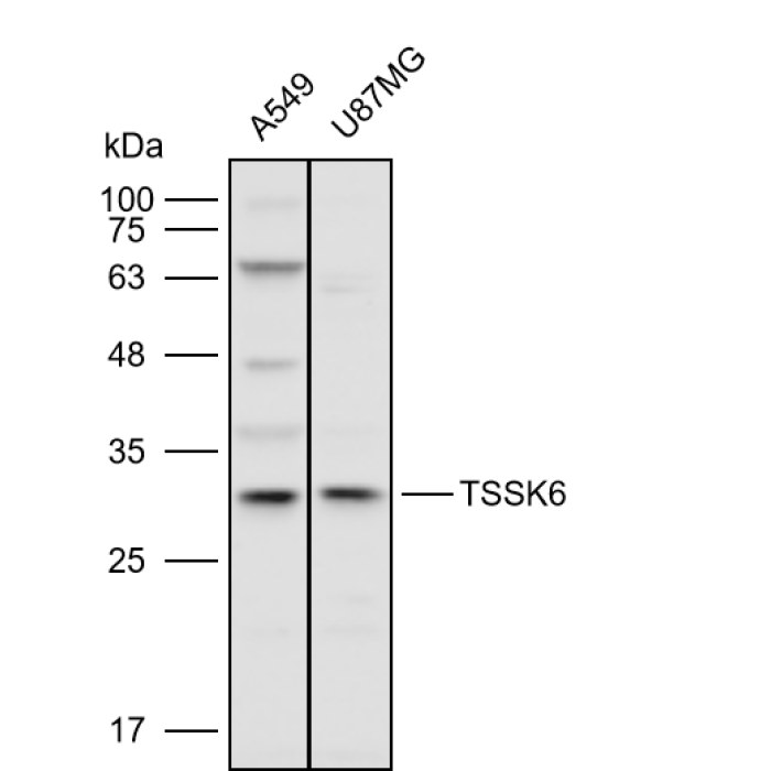 Solarbio K P Anti Tssk Polyclonal Antibody