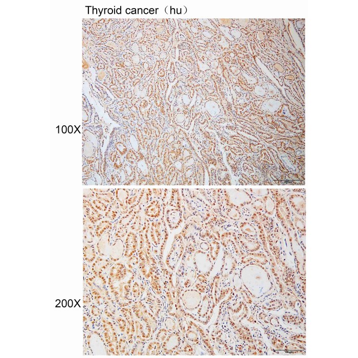 Solarbio K110938P Anti SS18L1 Polyclonal Antibody 试剂仪器耗材