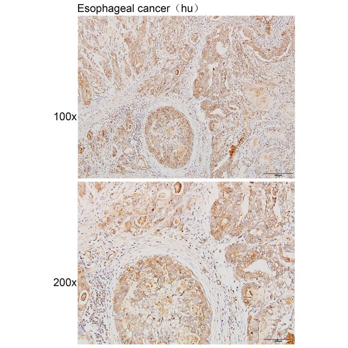 Solarbio K111612P Anti KIN Polyclonal Antibody 试剂仪器耗材