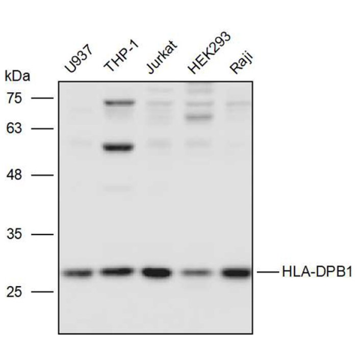 Solarbio K P Anti Hla Dpb Polyclonal Antibody