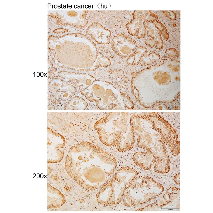 Solarbio K111016P Anti RBM6 Polyclonal Antibody 试剂仪器耗材