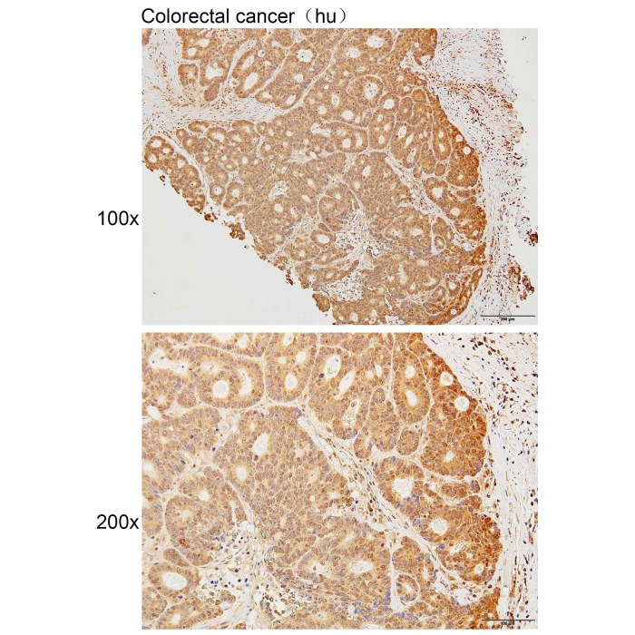 Solarbio K111635P Anti MOV10L1 Polyclonal Antibody 试剂仪器耗材