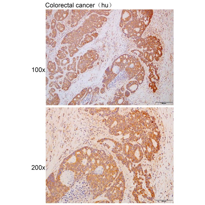 Solarbio K P Anti Kcnn Polyclonal Antibody