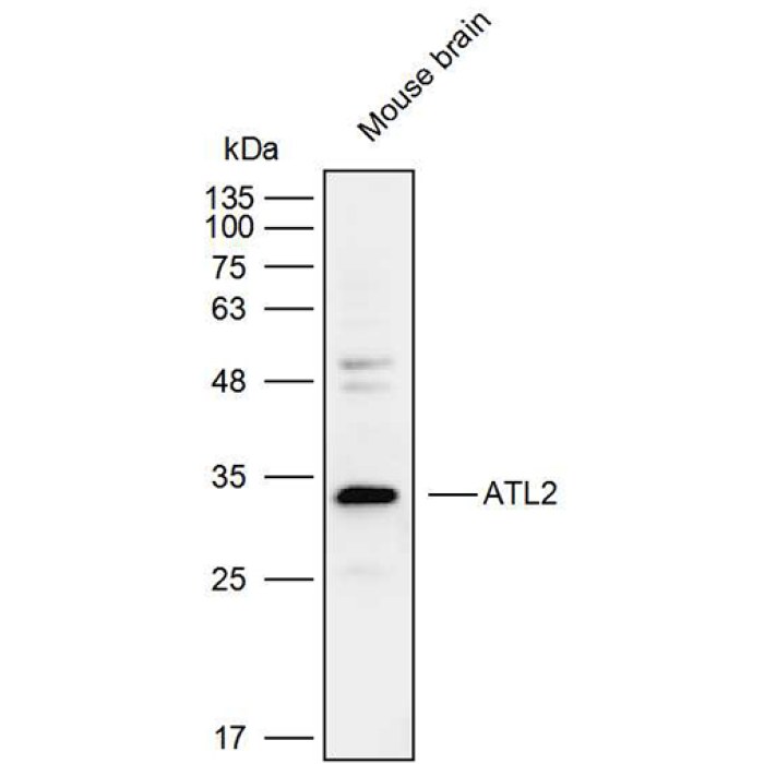 Solarbio K111800P Anti ATL2 Polyclonal Antibody 试剂仪器耗材