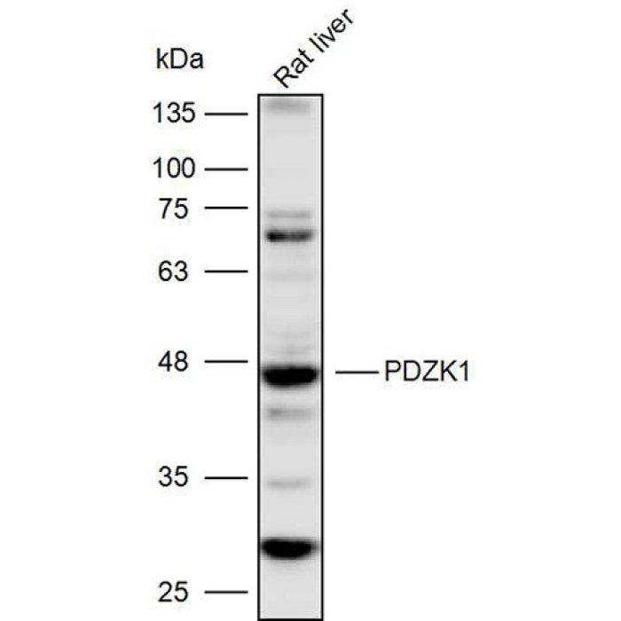 Solarbio K P Anti Pdzk Polyclonal Antibody