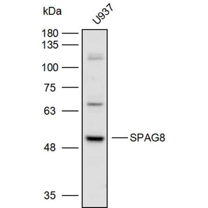 Solarbio K P Anti Spag Polyclonal Antibody