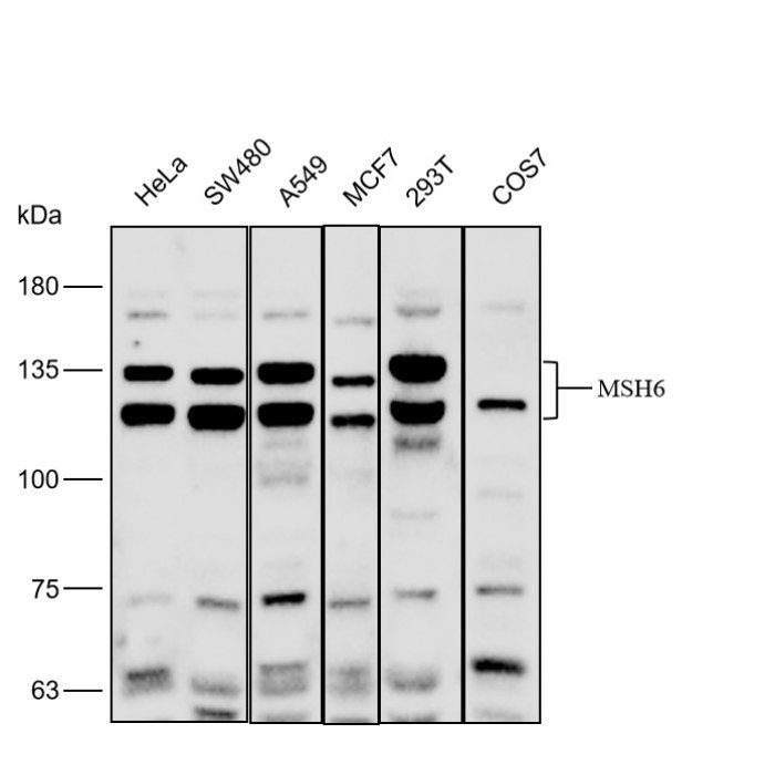 Solarbio K P Anti Msh Polyclonal Antibody