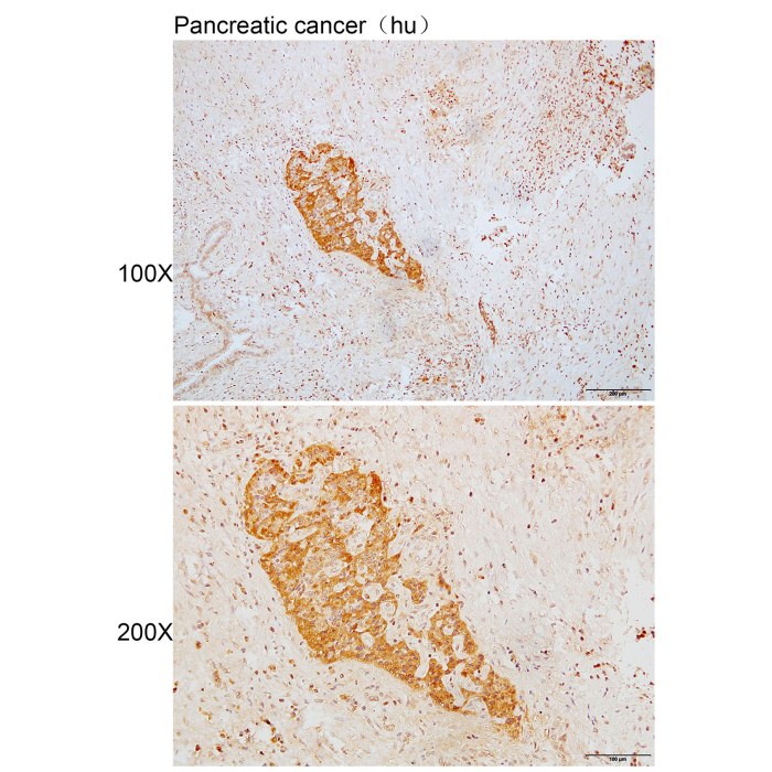 Solarbio K110119P Anti VCL Polyclonal Antibody 试剂仪器耗材