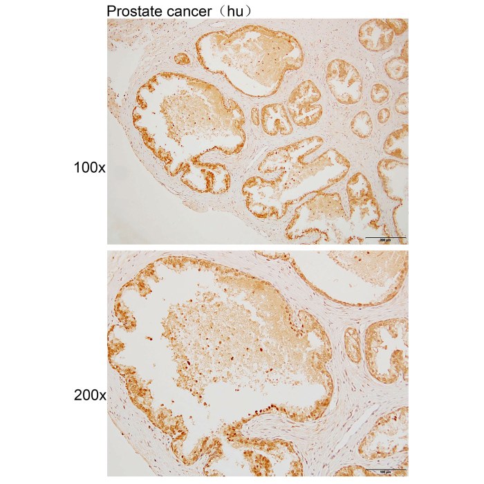 Solarbio K110049P Anti HDAC6 Polyclonal Antibody 试剂仪器耗材