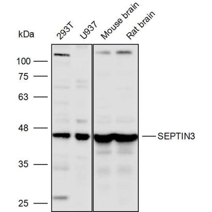 Solarbio K110306P Anti SEPTIN3 Polyclonal Antibody 试剂仪器耗材