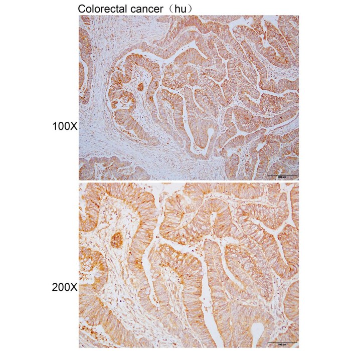 Solarbio K110352P Anti PISD Polyclonal Antibody 试剂仪器耗材