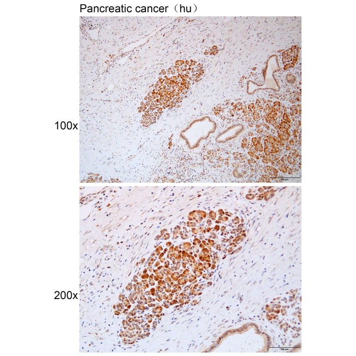 Solarbio K112186P Anti ATP7B Polyclonal Antibody 试剂仪器耗材