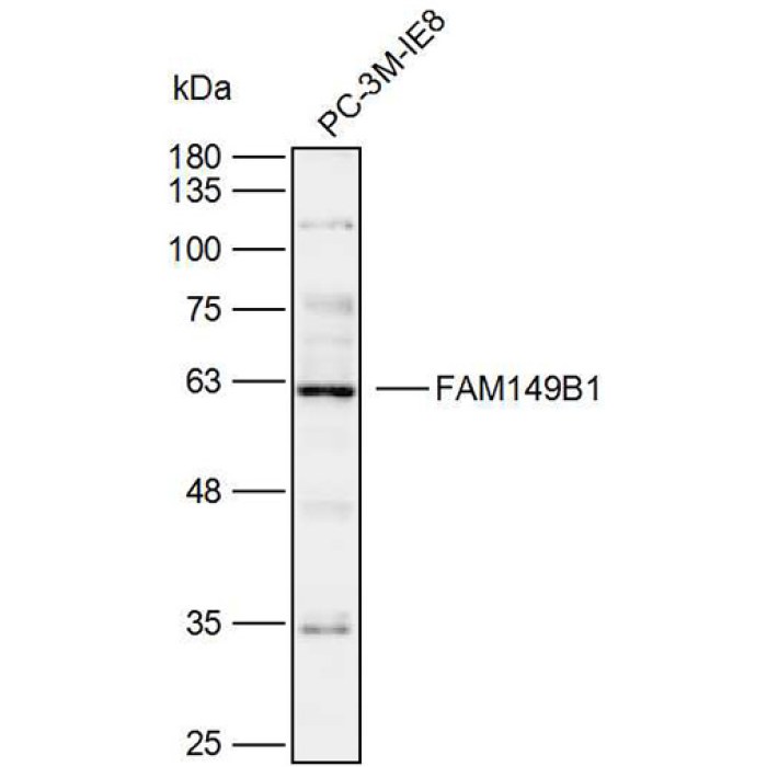 Solarbio K110074P Anti FAM149B1 Polyclonal Antibody 试剂仪器耗材