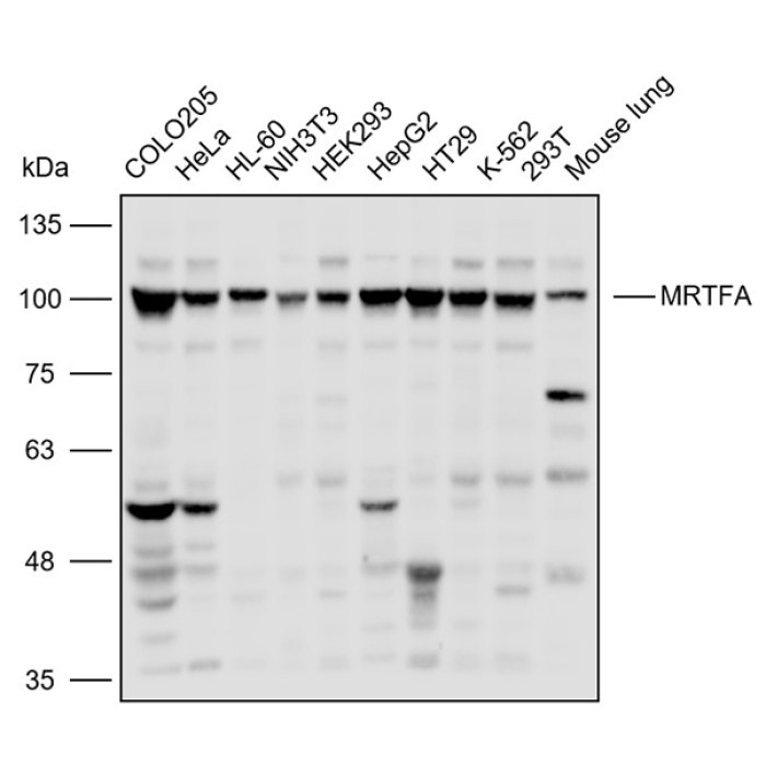 Solarbio K110461P Anti MRTFA Polyclonal Antibody 试剂仪器耗材