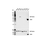 CST 4970 β-Actin (13E5) Rabbit mAb