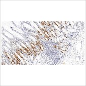 中杉 ZA-0115 胃泌素 Gastrin