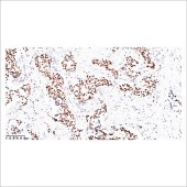 中杉 ZA-0554 AR(AndrogenReceptor)雄激素受体
