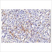 中杉 ZA-0662 CD42b抗体试剂(免疫组织化学)