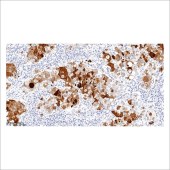 中杉 ZA-0552 HIF-1α抗体试剂（免疫组织化学）