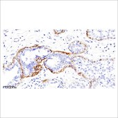 中杉 ZA-0524 试剂 Calponin抗体试剂（免疫组织化学)