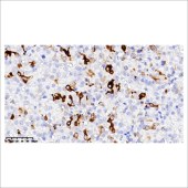 中杉 ZA-0640 ZA-0640 促甲状腺素 TSH