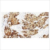 中杉 ZA-0565 E-Cadherin抗体试剂（免疫组织化学）