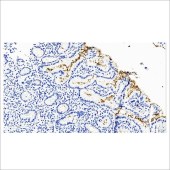 中杉 ZA-0127 Helicobacter phlori抗体试剂（免疫组织化学）