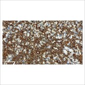 中杉 ZA-0511 Vimentin抗体试剂（免疫组织化学)