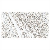 中杉 ZA-0624 SOX10蛋白