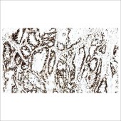 中杉 ZA-0541 MSH6抗体试剂