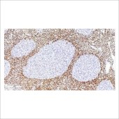 中杉 ZA-0536 bcl-2抗体试剂（免疫组织化学）