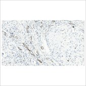 中杉 ZA-0568 CD31内皮细胞标记