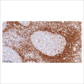 中杉 ZA-0443 IgD 抗体试剂（免疫组织化学）