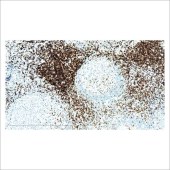 中杉 ZA-0503 0.2ml 兔抗人CD3单克隆抗体