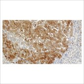 中杉 ZA-0615 Arginase-1蛋白