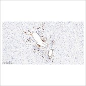 中杉 ZA-0550 CD34内皮细胞标记