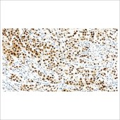 中杉 ZA-0665 HSP70抗体试剂（免疫组织化学）