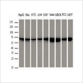 中杉 TA-14 试剂Mouse Anti-HSP60 (HSPD1) mAb