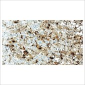 中杉 ZA-0596 试剂Prolactin
