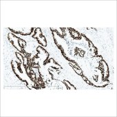 中杉 ZA-0520 CDX-2抗体试剂（免疫组织化学）