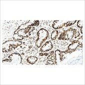 中杉 ZA-0622 MSH2抗体试剂