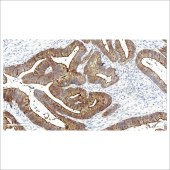 中杉 ZA-0575 微管素抗体试剂（免疫组织化学）