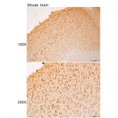 Solarbio K111988P Anti-ART3 Polyclonal Antibody