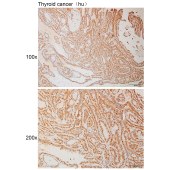 Solarbio K110998P Anti-CABP7 Polyclonal Antibody