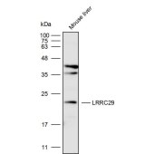 Solarbio K111665P Anti-LRRC29 Polyclonal Antibody