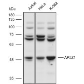 Solarbio K110712P Anti-AP5Z1 Polyclonal Antibody