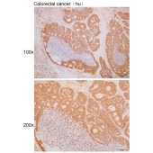 Solarbio K111740P Anti-CAPS2 Polyclonal Antibody