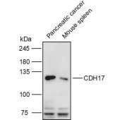 Solarbio K111128P Anti-CDH17 Polyclonal Antibody