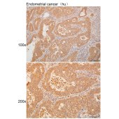 Solarbio K111304P Anti-CDH1/2/3/4 Polyclonal Antibody